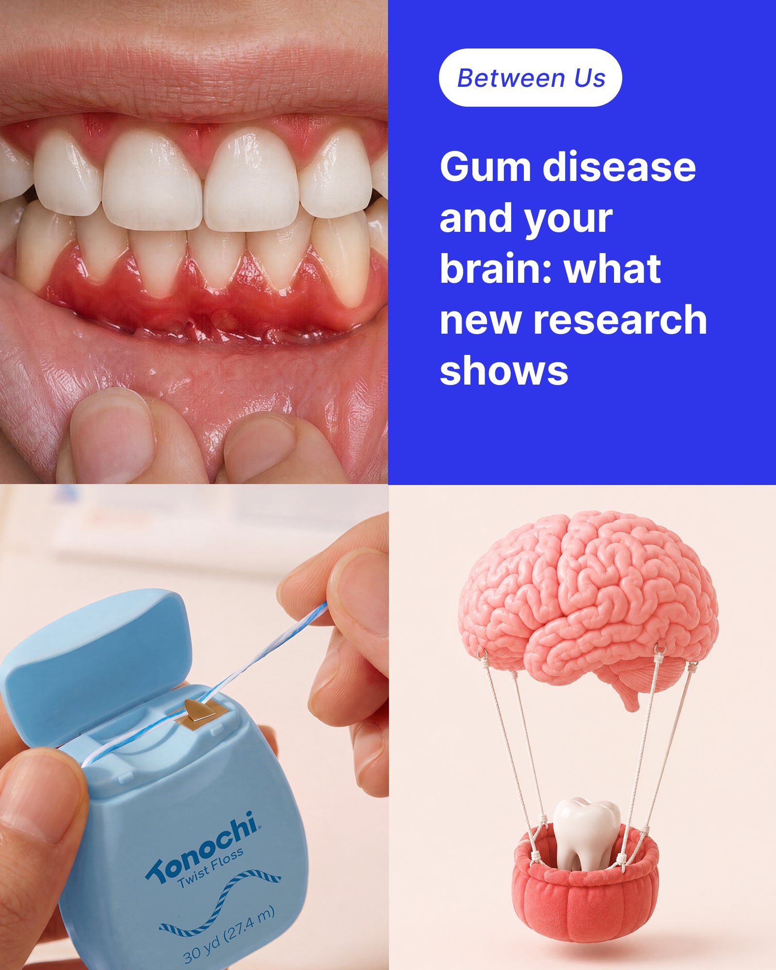 Gum Disease and Your Brain: What New Research Shows