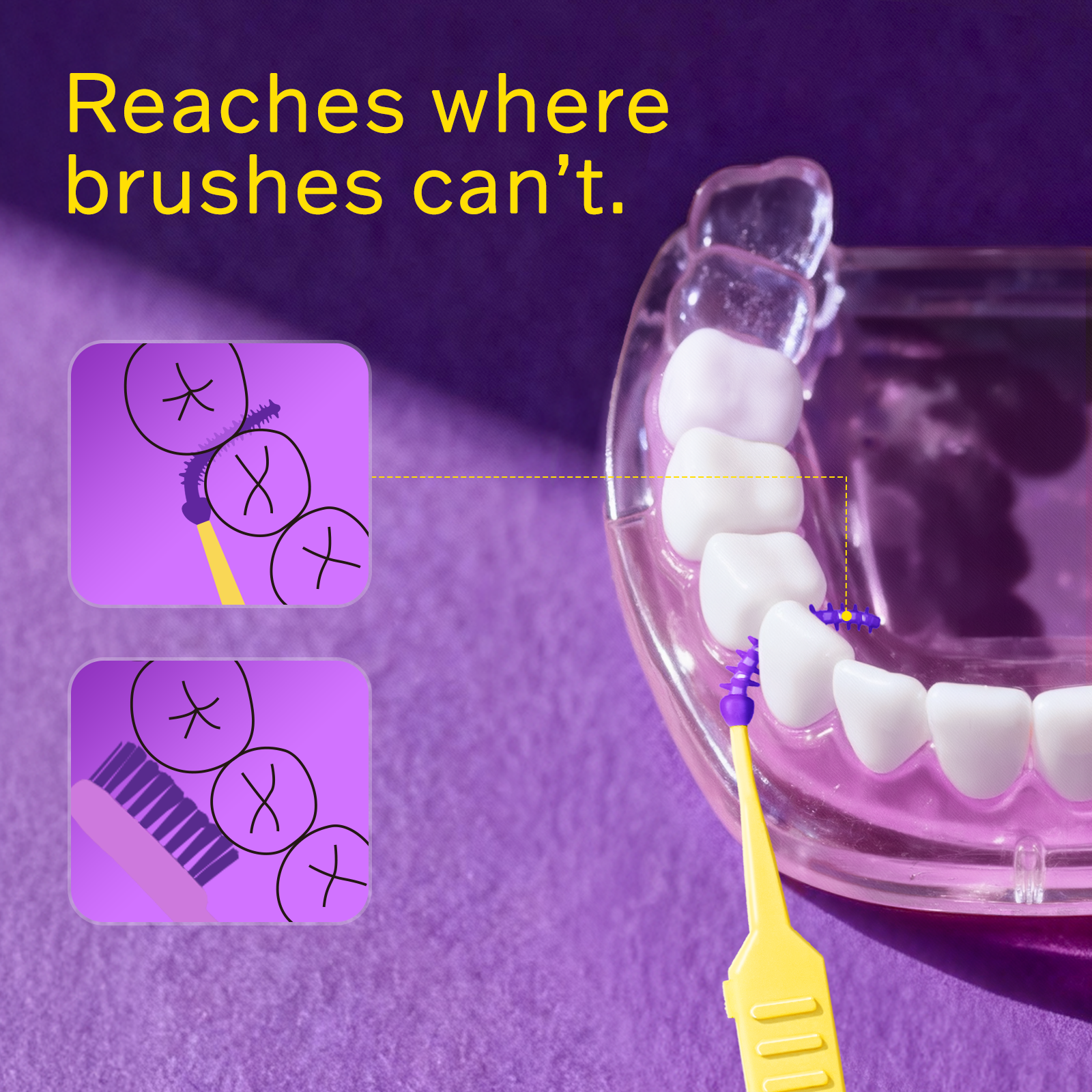 Purple and yellow Tonochi interdental brush cleaning tight spaces between clear dental model teeth with text 'Reaches where brushes can't.'